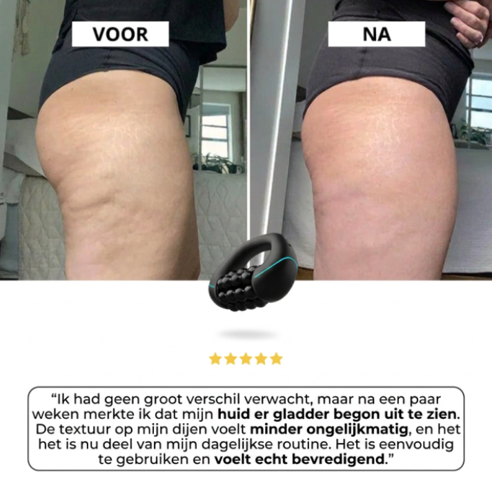 Vitalora LymphoFlow™  Strakke Huid, Minder Cellulitis – Lymphatische Roller Massager