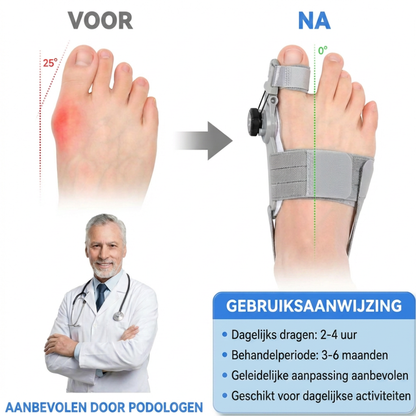 Vitalora AlignFix™- Pijnvrije Voeten, Elke Dag – Bunion Corrector