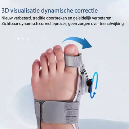 Vitalora AlignFix™- Pijnvrije Voeten, Elke Dag – Bunion Corrector